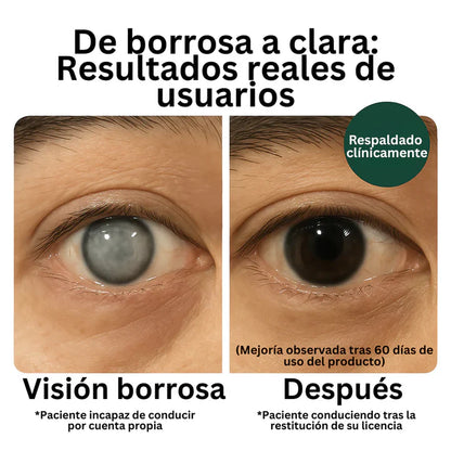 OjoFuerte | Dile adiós al ardor, la borrosidad y el cansancio visual